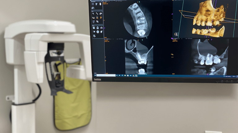 Endodontist in Baltimore | Painless Root Canal | Sterling Endo